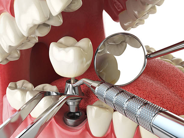Best Emergency Dental Care for Broken or Chipped Teeth in Cumberland Center, ME